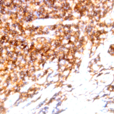 CD138 Antibody in Immunohistochemistry (Paraffin) (IHC (P))