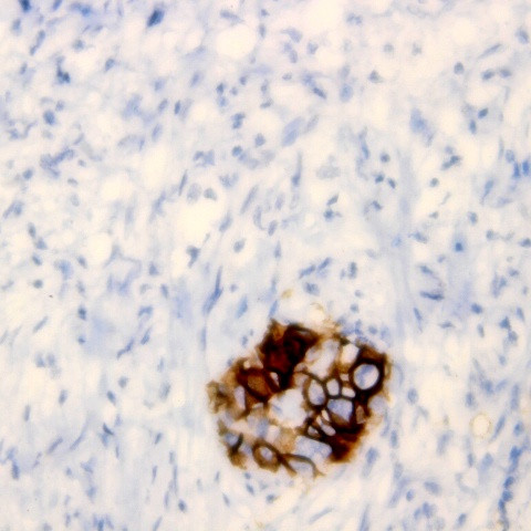 CD58 Antibody in Immunohistochemistry (Paraffin) (IHC (P))