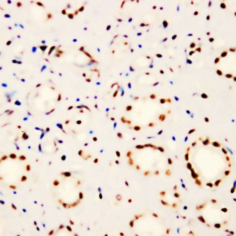 FANCD2 Antibody in Immunohistochemistry (Paraffin) (IHC (P))