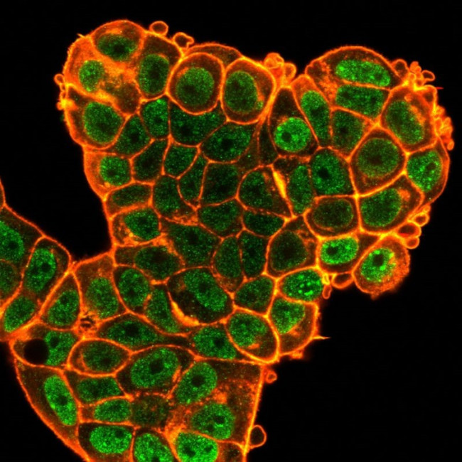 BCL6 Antibody in Immunocytochemistry (ICC/IF)