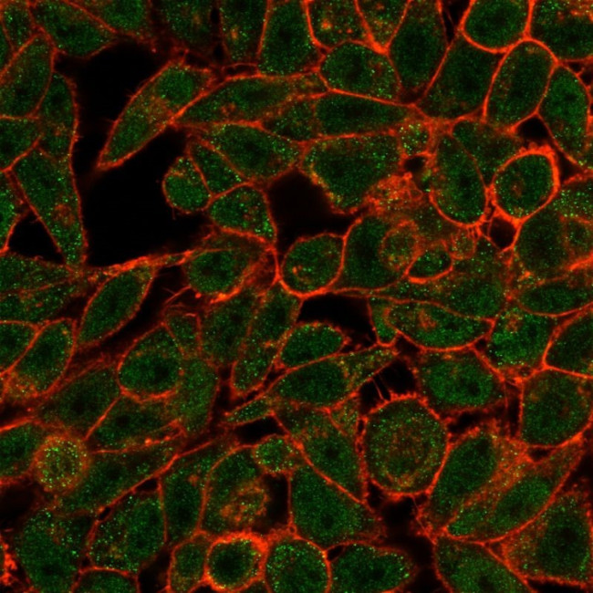 BCL6 Antibody in Immunocytochemistry (ICC/IF)