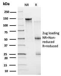 BCL6 Antibody in SDS-PAGE (SDS-PAGE)