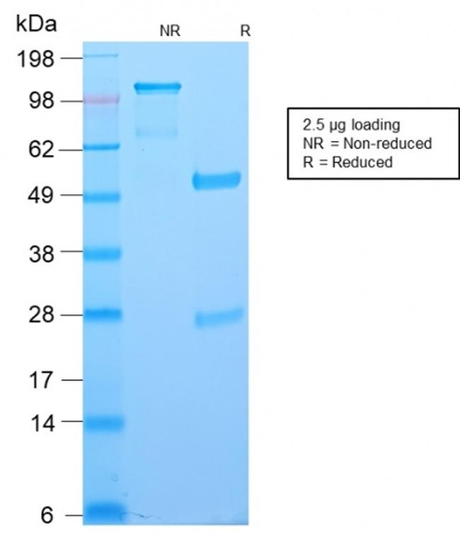 Bcl-6 Antibody in SDS-PAGE (SDS-PAGE)