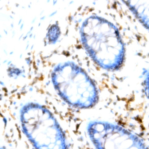 CD94 Antibody in Immunohistochemistry (Paraffin) (IHC (P))