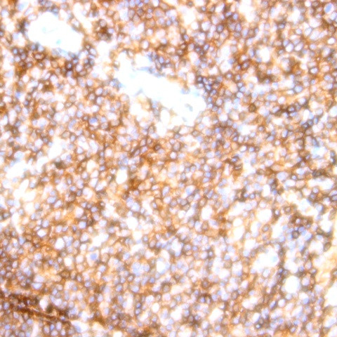 CD158a Antibody in Immunohistochemistry (Paraffin) (IHC (P))