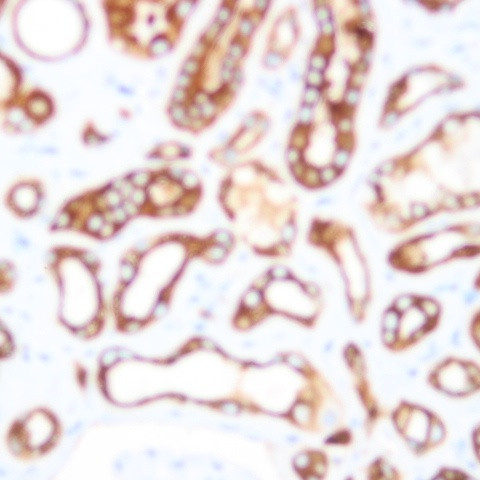 NKB1 Antibody in Immunohistochemistry (Paraffin) (IHC (P))