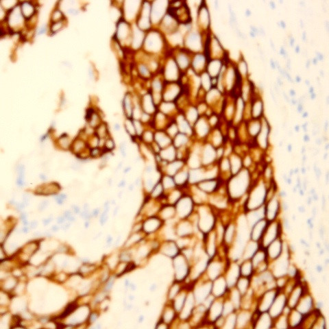 Cytokeratin 6 Antibody in Immunohistochemistry (Paraffin) (IHC (P))