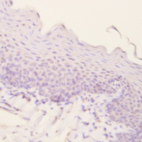 Collagen II Antibody in Immunohistochemistry (Paraffin) (IHC (P))