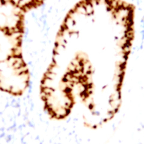 Cyclin A2 Antibody in Immunohistochemistry (Paraffin) (IHC (P))