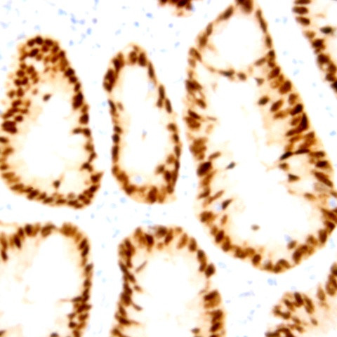 cyclin E Antibody in Immunohistochemistry (Paraffin) (IHC (P))