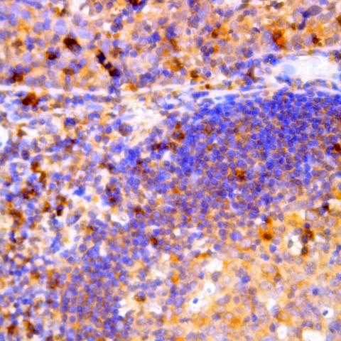 p59/FYN Antibody in Immunohistochemistry (Paraffin) (IHC (P))