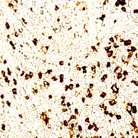 Human IgG1 Antibody in Immunohistochemistry (Paraffin) (IHC (P))