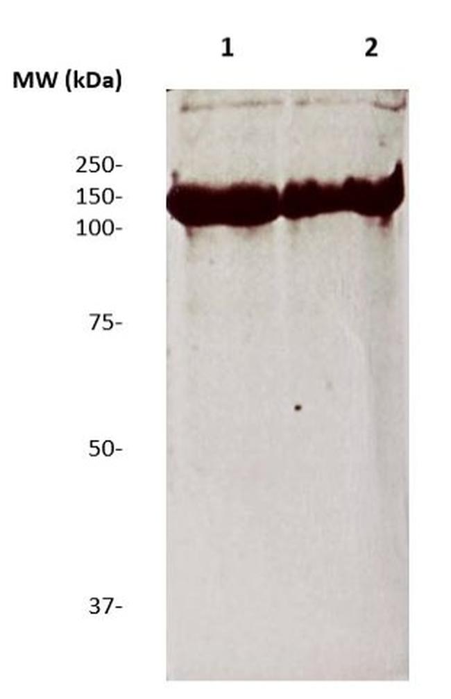 Human IgG4 Antibody in Western Blot (WB)