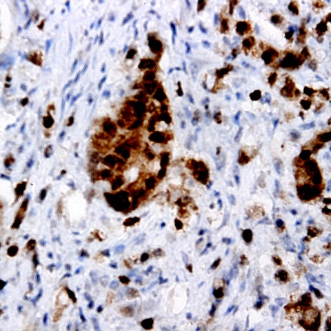 JNK1 Antibody in Immunohistochemistry (Paraffin) (IHC (P))