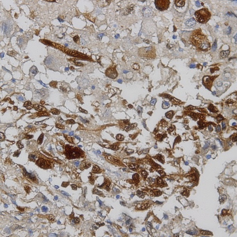 MAGE1 Antibody in Immunohistochemistry (Paraffin) (IHC (P))