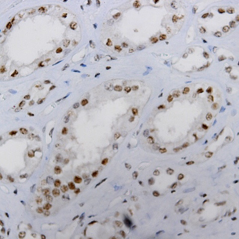 MALT-1 Antibody in Immunohistochemistry (Paraffin) (IHC (P))