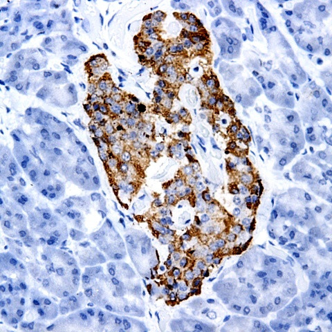 MMP1 Antibody in Immunohistochemistry (PFA fixed) (IHC (PFA))