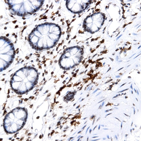 PIN-1 Antibody in Immunohistochemistry (Paraffin) (IHC (P))