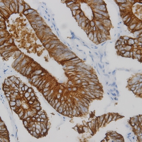 RRUT-3 Antibody in Immunohistochemistry (Paraffin) (IHC (P))