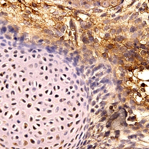 SOX-11 Antibody in Immunohistochemistry (Paraffin) (IHC (P))