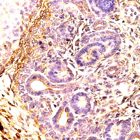 SSEA-4 Antibody in Immunohistochemistry (Paraffin) (IHC (P))