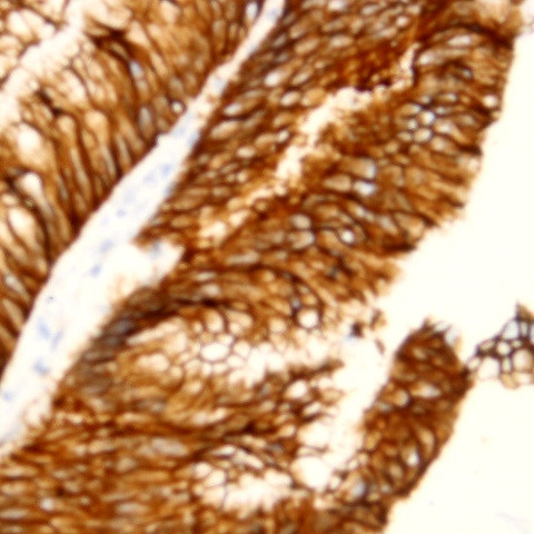 Telomerase Reverse Transcriptase (TERT) Antibody in Immunohistochemistry (Paraffin) (IHC (P))