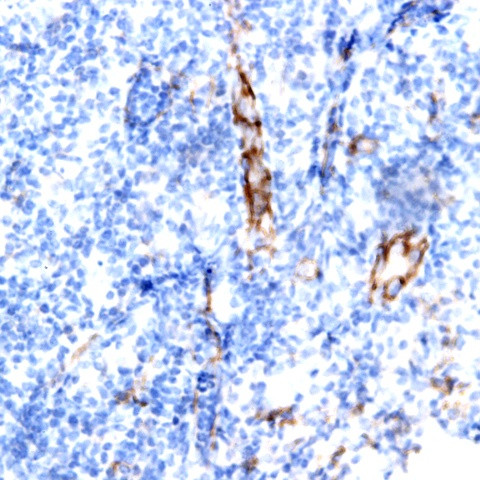 TSC1 (Hamartin) Antibody in Immunohistochemistry (Paraffin) (IHC (P))