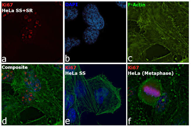 Ki-67 Antibody in Immunocytochemistry (ICC/IF)