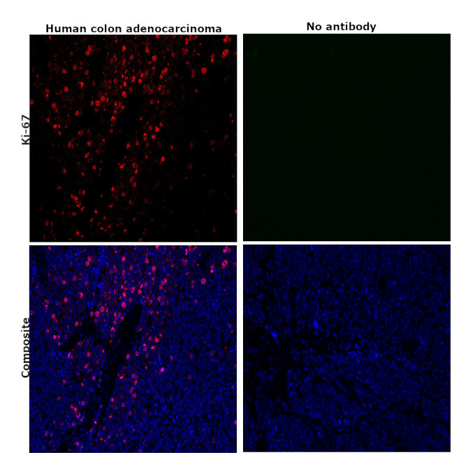 Ki-67 Antibody in Immunohistochemistry (Paraffin) (IHC (P))