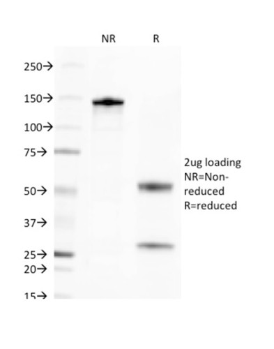 CD269/TNFRSF17/BCMA (B-Cell Maturation Protein) Antibody in SDS-PAGE (SDS-PAGE)