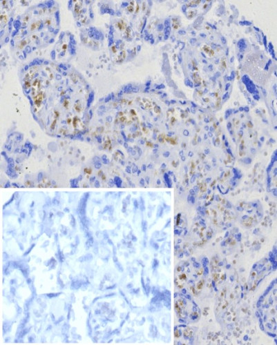 CD269/TNFRSF17/BCMA (B-Cell Maturation Protein) Antibody in Immunohistochemistry (Paraffin) (IHC (P))