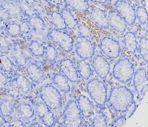 CD269/TNFRSF17/BCMA (B-Cell Maturation Protein) Antibody in Immunohistochemistry (Paraffin) (IHC (P))