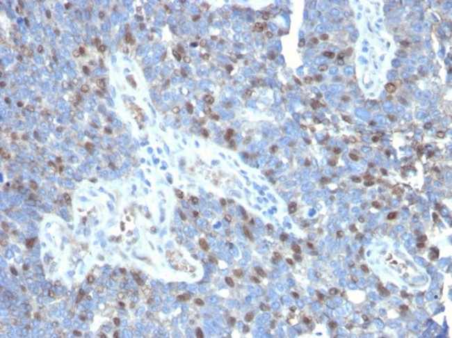 ROR-gamma/RORC (RAR-related Orphan Receptor C) Antibody in Immunohistochemistry (Paraffin) (IHC (P))