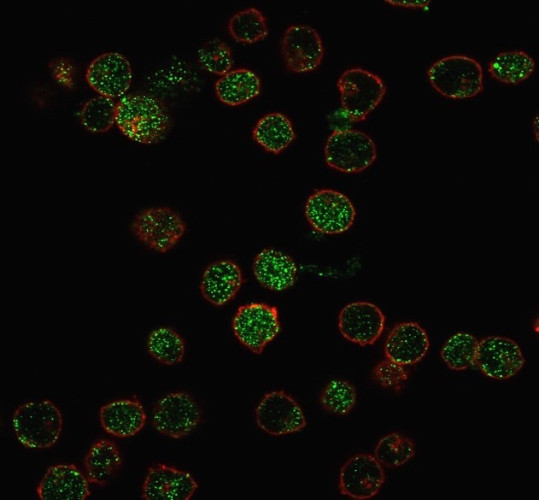 ROR-gamma/RORC (RAR-related Orphan Receptor C) Antibody in Immunocytochemistry (ICC/IF)