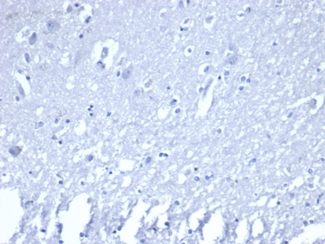 ROR-gamma/RORC (RAR-related Orphan Receptor C) Antibody in Immunohistochemistry (Paraffin) (IHC (P))