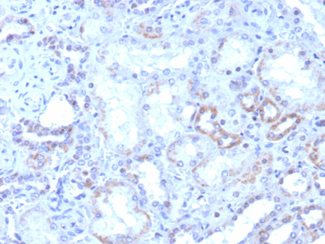 ROR-gamma/RORC (RAR-related Orphan Receptor C) Antibody in Immunohistochemistry (Paraffin) (IHC (P))