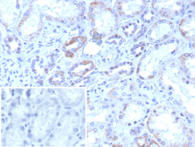 ROR-gamma/RORC (RAR-related Orphan Receptor C) Antibody in Immunohistochemistry (Paraffin) (IHC (P))