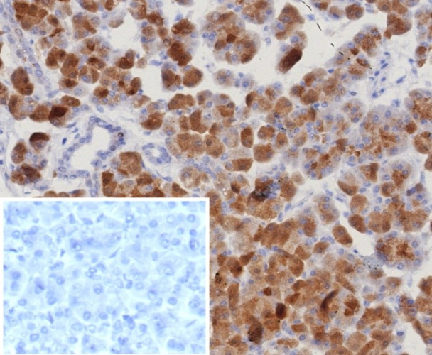 ROR-gamma/RORC (RAR-related Orphan Receptor C) Antibody in Immunohistochemistry (Paraffin) (IHC (P))