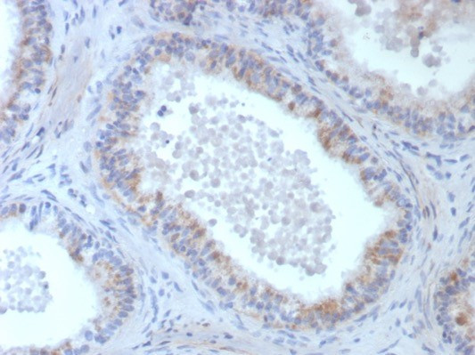 ROS1 Antibody in Immunohistochemistry (Paraffin) (IHC (P))