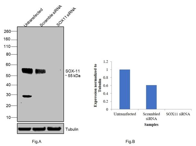 Sheep IgG (H+L) Secondary Antibody in Western Blot (WB)