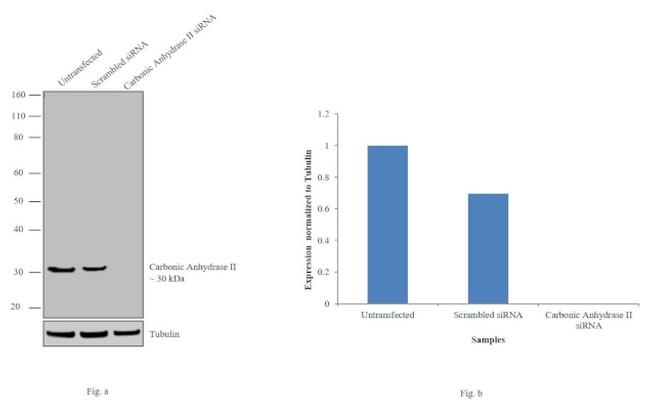 Sheep IgG (H+L) Secondary Antibody in Western Blot (WB)