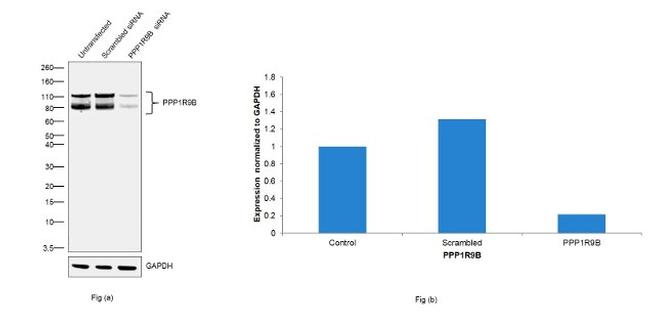 Sheep IgG (H+L) Secondary Antibody in Western Blot (WB)