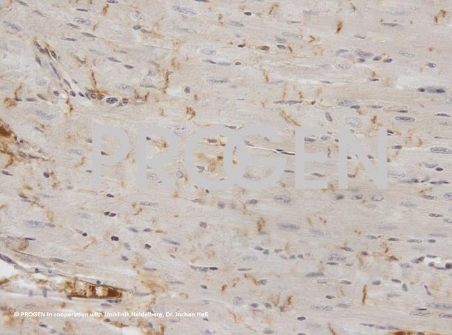 Desmoplakin 1/2 Antibody in Immunohistochemistry (IHC)