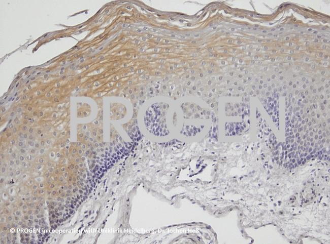 Desmoplakin 1/2 Antibody in Immunohistochemistry (IHC)