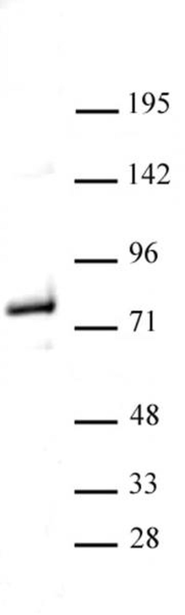 Menin Antibody in Western Blot (WB)