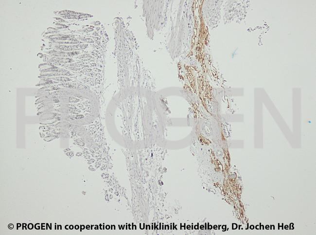 Adipophilin Antibody in Immunohistochemistry (IHC)