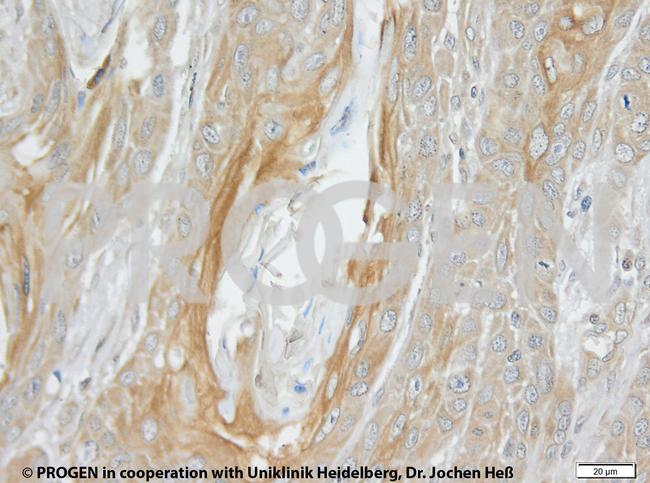 Cytokeratin Pan Type I/II Antibody in Immunohistochemistry (IHC)