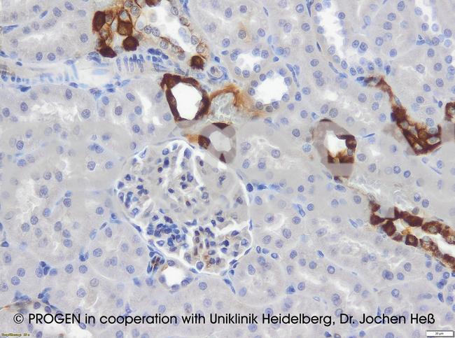 Cytokeratin 18 Antibody in Immunohistochemistry (IHC)