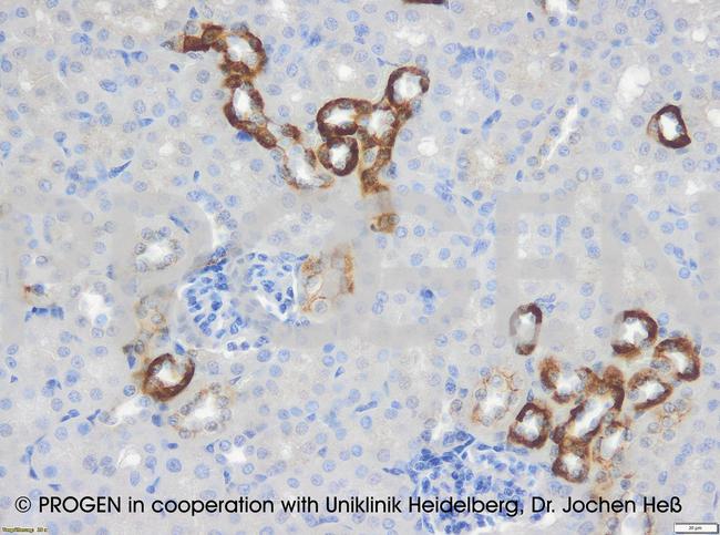 Cytokeratin 18 Antibody in Immunohistochemistry (IHC)