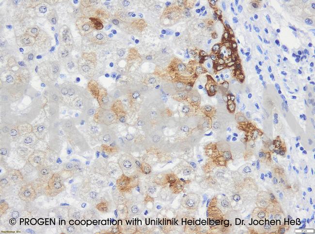 Cytokeratin 18 Antibody in Immunohistochemistry (IHC)